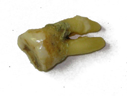 human-tooth
